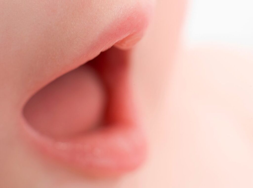 Tratamiento de fisioterapia en post frenectomía