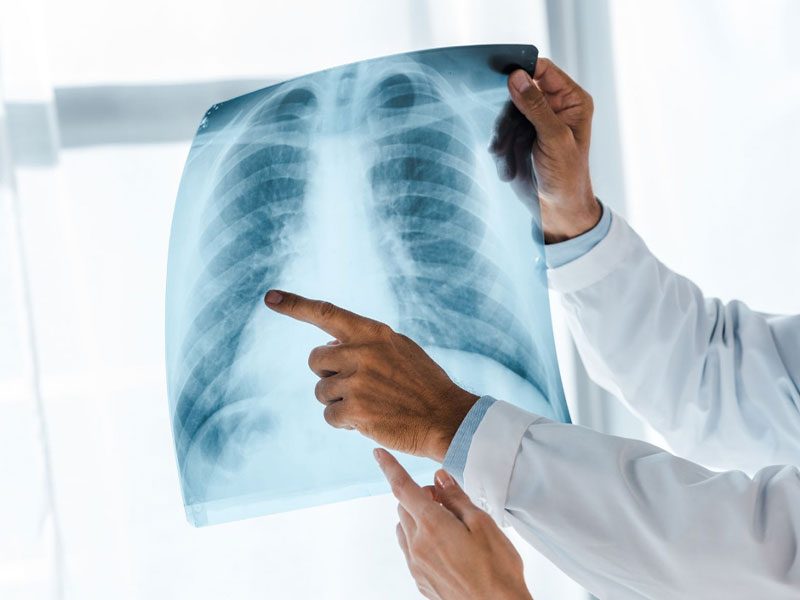 Radiología y Rayos X tavernes de la valldigna para diagnóstico y tratamiento de fisioterapia Radiología y Rayos X tavernes de la valldigna para diagnóstico y tratamiento de fisioterapia